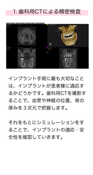 1.歯科用CTによる精密検査