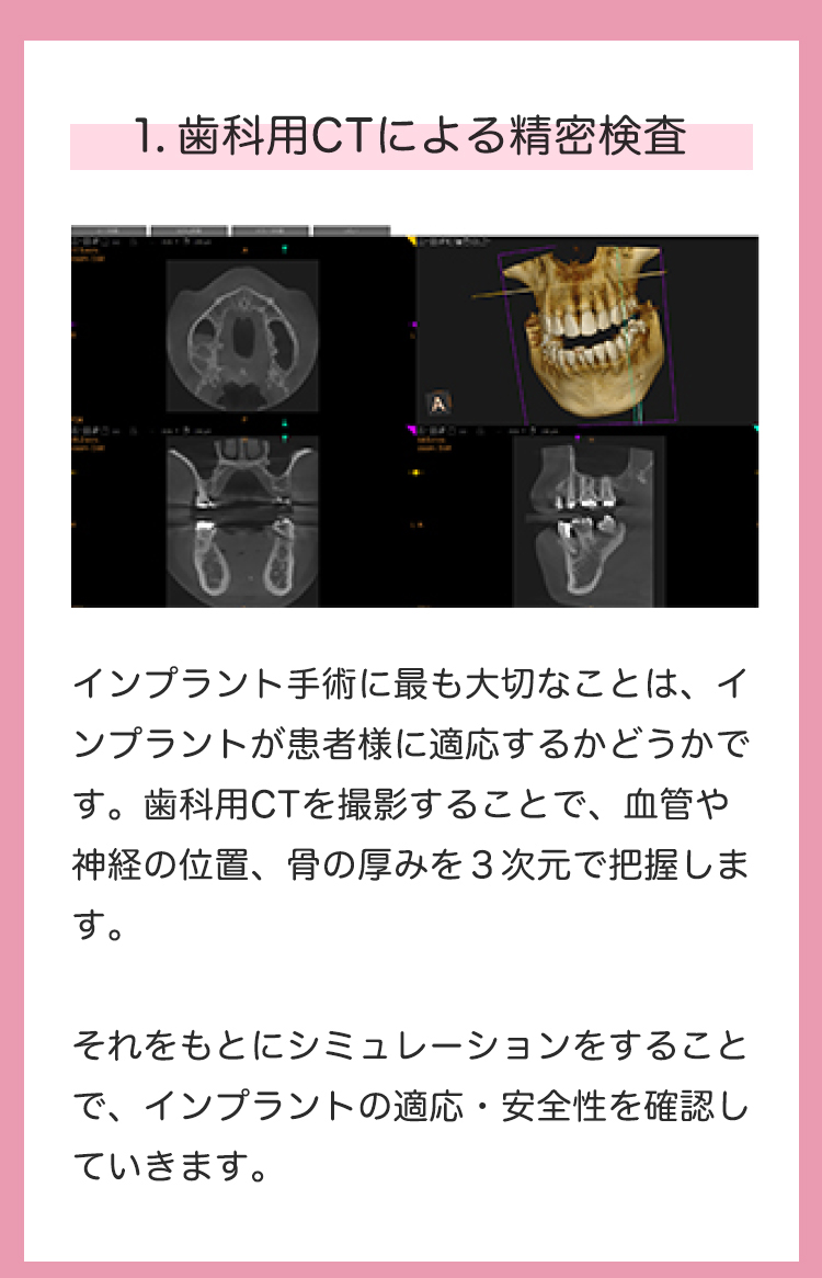 1.歯科用CTによる精密検査