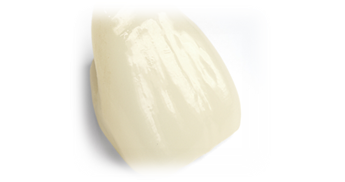 インプラントポイント