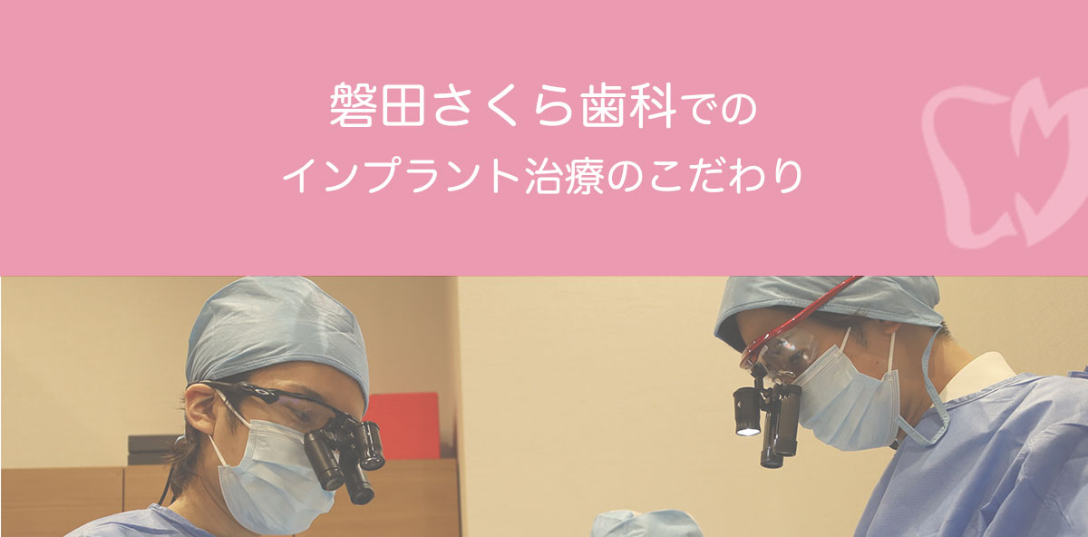 インプラント治療のこだわり