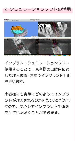 2.シミュレーションソフトの活用