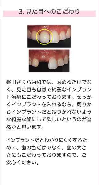 3.見た目へのこだわり