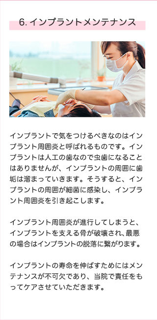 インプラント治療のこだわり