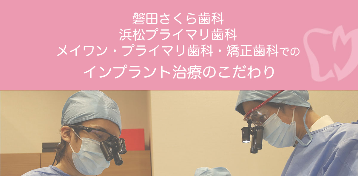 インプラント治療のこだわり