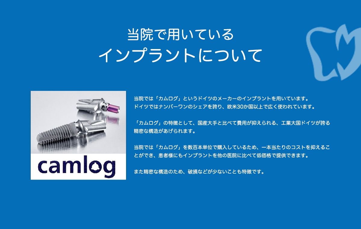 インプラントについて
