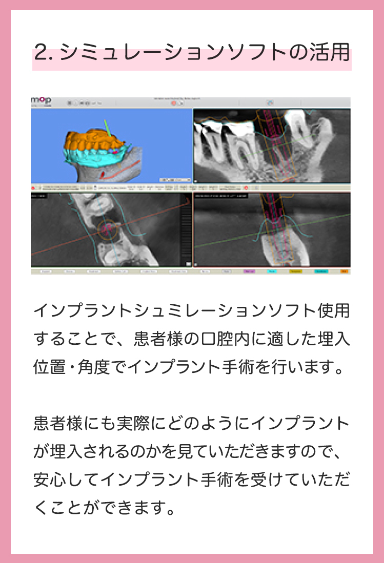 2.シミュレーションソフトの活用