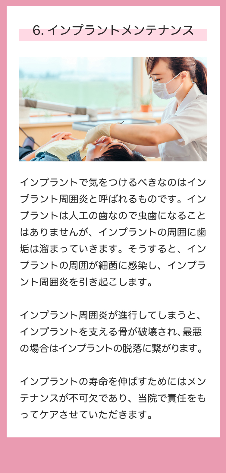 インプラント治療のこだわり