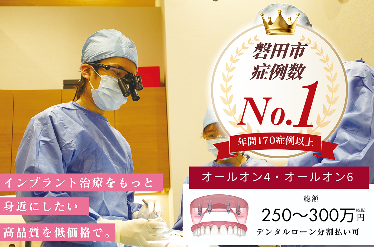 インプラントで快適な食生活を